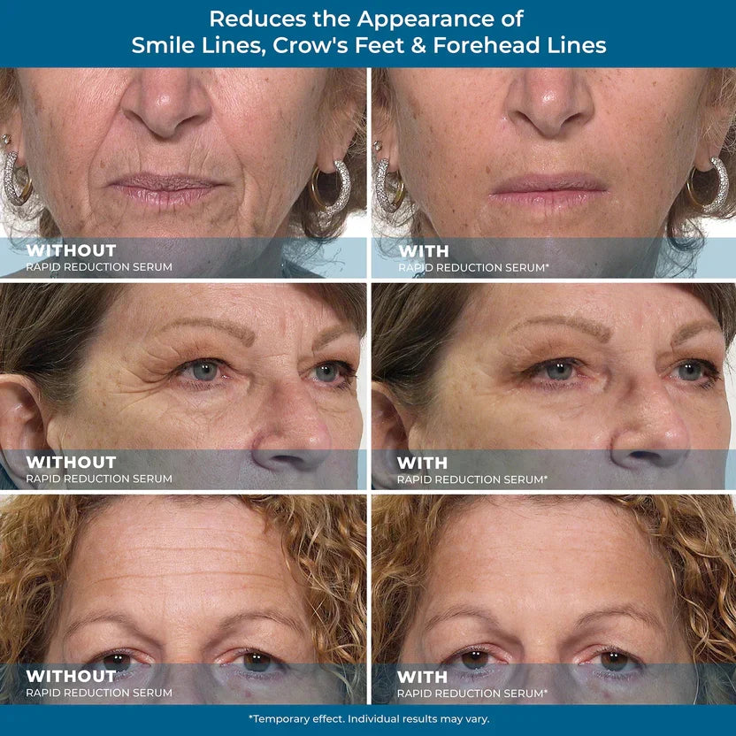 Plexaderm Rapid Reduction Eye Serum - Visibly Reduces Under-Eye Bags, Wrinkles, Dark Circles, Fine Lines & Crow's Feet Instantly, Anti Aging Wrinkle Remover for Face, Full Size Tube
